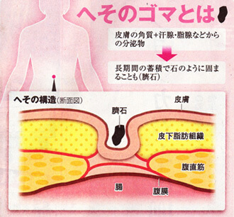 妊婦のへそのゴマは掃除しても大丈夫 安全な掃除方法を徹底解説